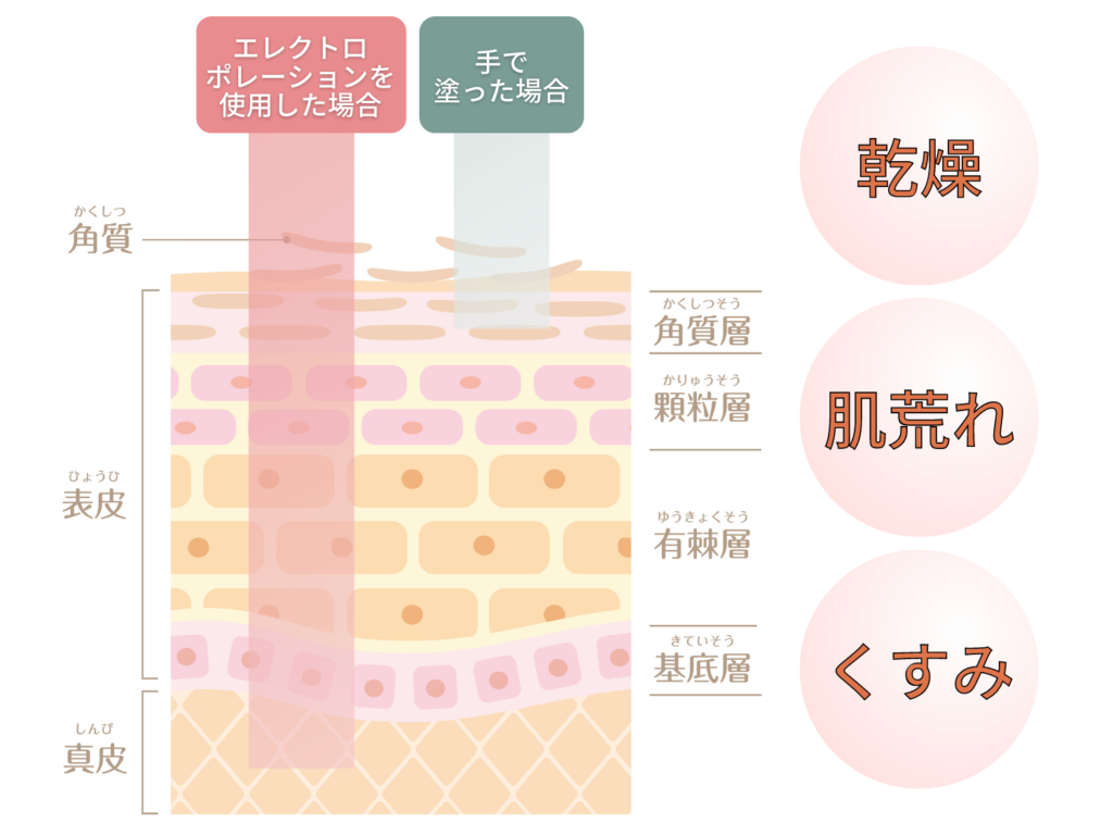 エレクトロポレーション浸透